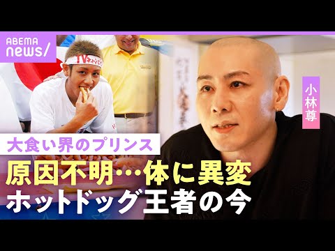 【小林尊】「90秒で12Lの水を飲む」大食いで過酷トレーニング…代償は"原因不明の体の異変” 番組出演時代の収入は｜N…