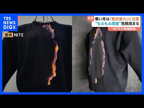 わずか5秒で“服が火に包まれる”…冬の「もふもふ火災」に注意　毎年約100人死亡の「着衣着火」 “表面フラッシュ現象”… サムネイル