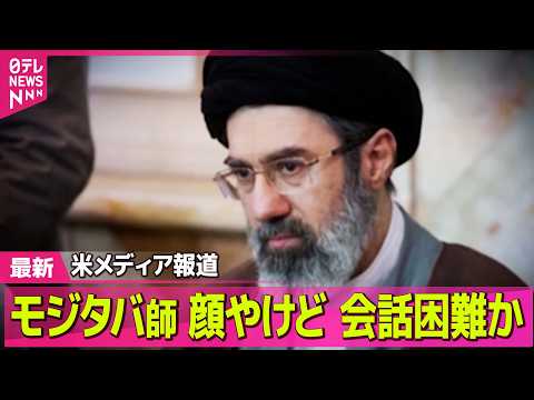 【最新イラン情勢】イラン最高指導者・モジタバ師は重傷…顔にやけど負い話すのが困難な状況か　米報道──国際ニュースライブ… サムネイル