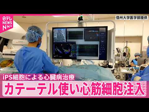 【iPS細胞による心臓病治療】患者の体への負担少ないカテーテル使った世界初の治験