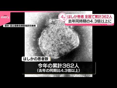 【はしか】全国患者数ことし累計362人で  去年同時期の4.3倍以上に サムネイル