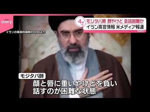 【イラン最高指導者】モジタバ師は重傷  顔にやけど負い話すのが困難な状況か  アメリカ報道 サムネイル