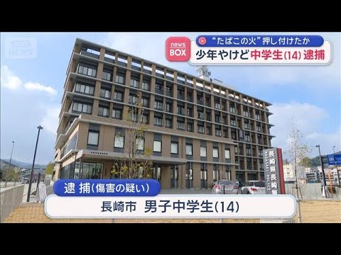 “たばこの火”押し付けたか 少年やけど　中学生（14）逮捕　長崎市【スーパーJチャンネル】(2026年5月26日) サムネイル