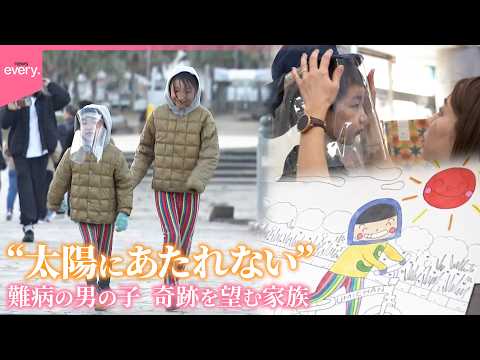 【難病】“太陽にあたれない”男の子  限られた時間…奇跡を望む家族『every.特集』