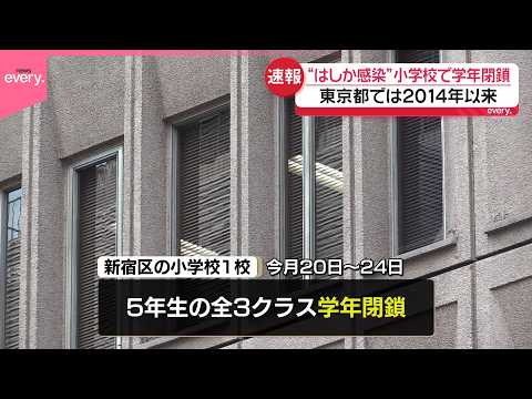 【“はしか感染”】都内の小学校で学年閉鎖  東京都では2014年以来 サムネイル
