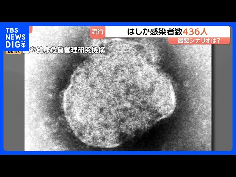 今年のはしか感染者数436人に　去年の約4.5倍のペースで拡大　感染のピークは4月中旬から6月下旬と推定 最悪の場合1… サムネイル