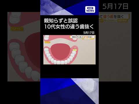 親知らずと誤認　歯茎に埋もれた別の歯を抜く　福井大病院　10代女性患者に謝罪shorts サムネイル