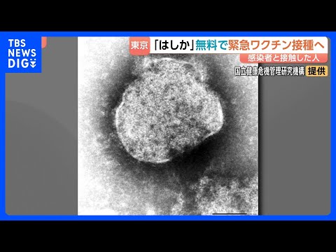 東京都「はしか」緊急ワクチン接種へ　72時間以内にはしか患者と接触した人が対象　感染拡大受け無料で実施｜TBS NEW… サムネイル