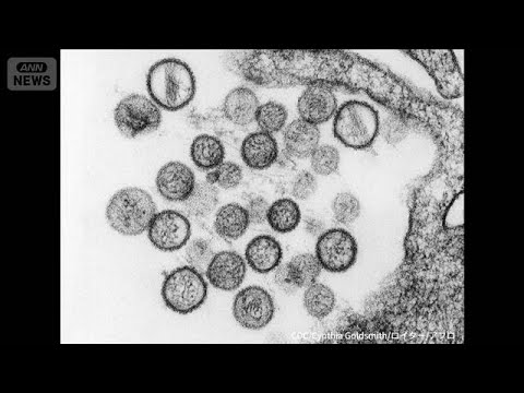 3人死亡　WHOが注意…日本は1999年以降感染なし(2026年5月4日) サムネイル