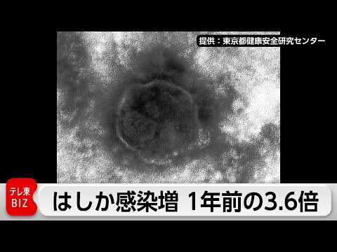 今年のはしか累計236人 1年前の3.6倍 サムネイル