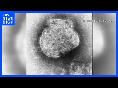 【速報】今年のはしか感染者数362人　直近10年で最多の2019年に次ぐペースで増加　国立健康危機管理研究機構｜TBS… サムネイル